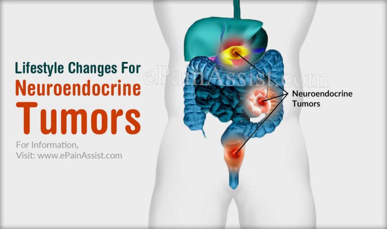Lifestyle Changes For Neuroendocrine Tumors