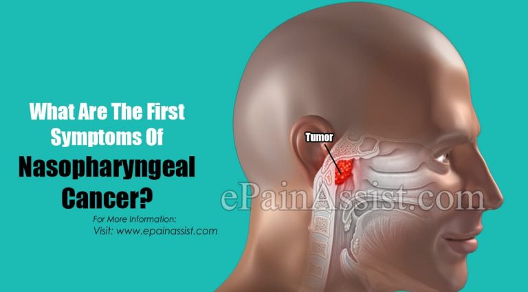 What Are The First Symptoms Of Nasopharyngeal Cancer & How Do You Test For It?