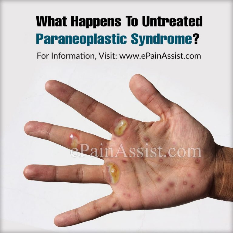 What Happens To Untreated Paraneoplastic Syndrome & When To Go To Doctor?