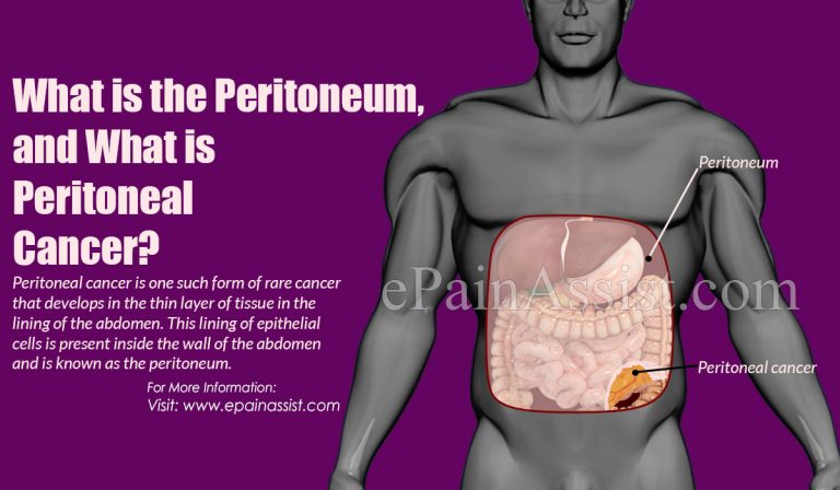 What is the Peritoneum and what is Peritoneal Cancer: Types, Symptoms, Stages, Treatment of Peritoneal Cancer