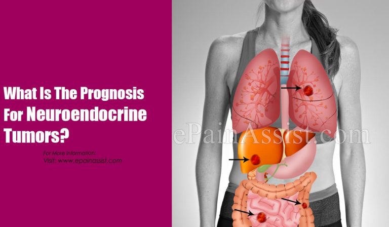 What Is The Prognosis For Neuroendocrine Tumors?