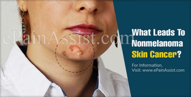 What Leads To Nonmelanoma Skin Cancer & Can It Be Cured?