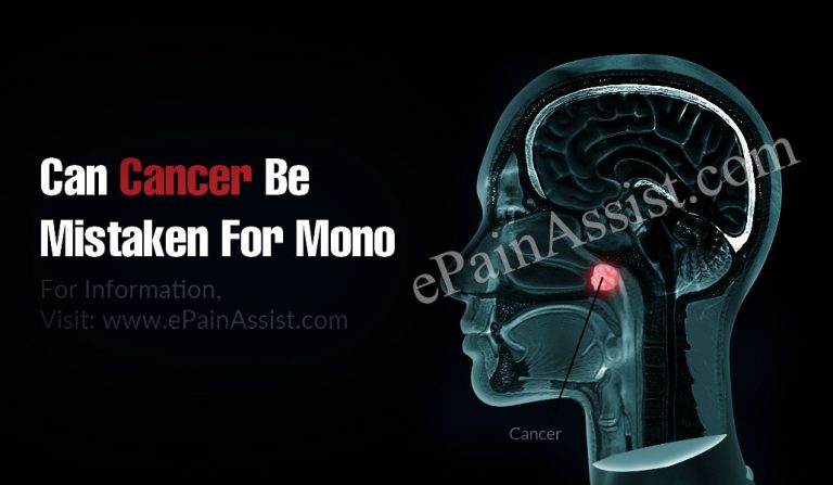 Can Cancer Be Mistaken For Mono?