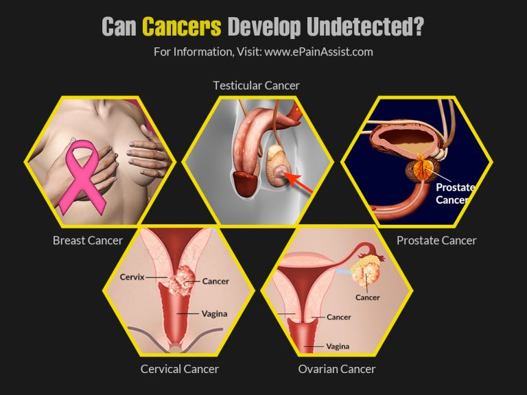How Long Can You Have Cancer Without Finding Out About It?