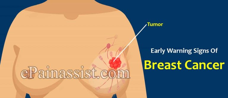 Early Warning Signs Of Breast Cancer: What Are The Symptoms Of Breast Cancer Besides A Lump?
