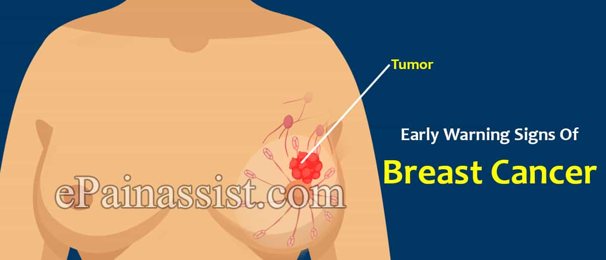 Early Warning Signs Of Breast Cancer