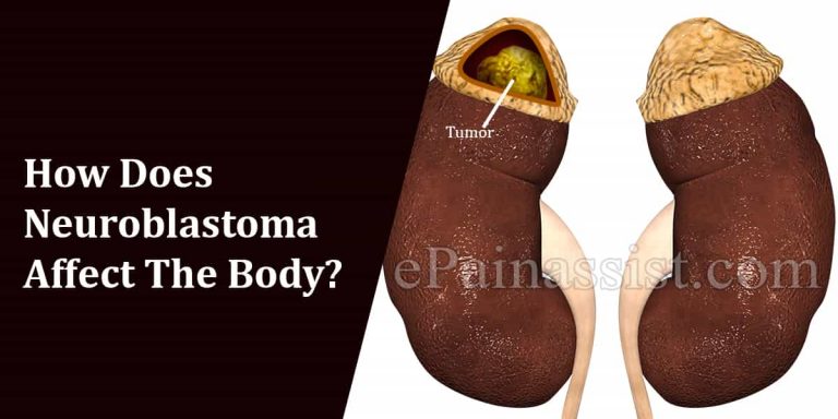 How Does Neuroblastoma Affect The Body & What Triggers It?