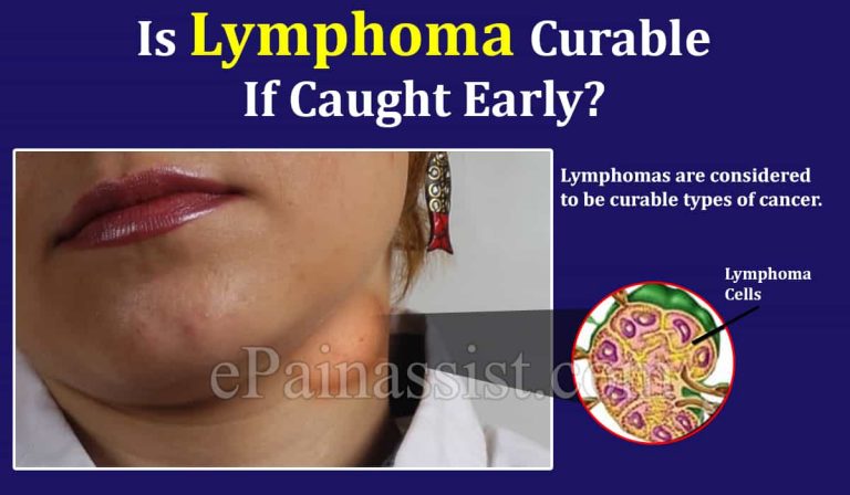 Is Lymphoma Curable If Caught Early?