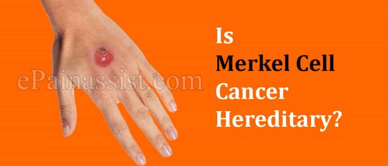 Is Merkel Cell Cancer Hereditary & Is Carcinoma Worse Than Melanoma?