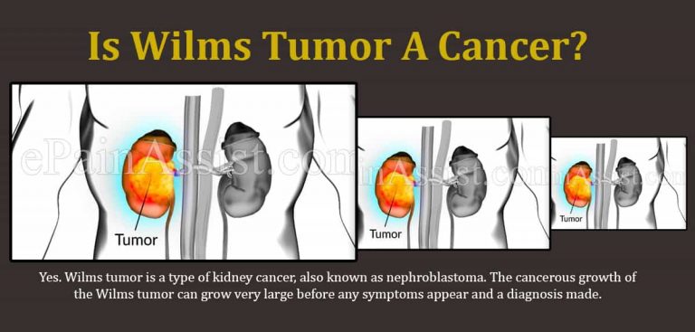 Is Wilms Tumor A Cancer & What Does It Feel Like?