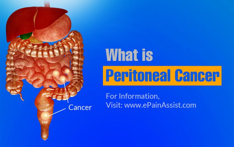 What is Peritoneal Cancer, Know its Types, Symptoms, Stages, Treatment