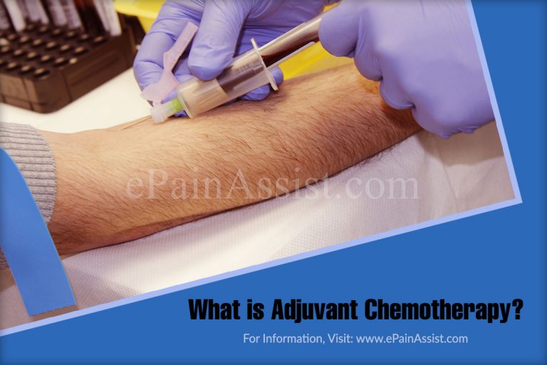 What is Adjuvant Chemotherapy?