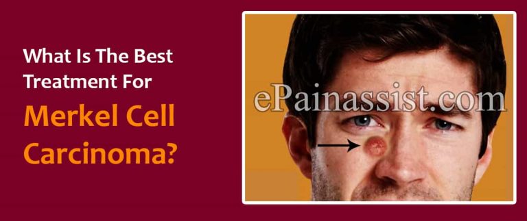 What Is The Best Treatment For Merkel Cell Carcinoma?