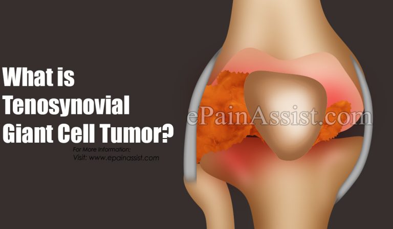 What is Tenosynovial Giant Cell Tumor: Types, Causes, Signs, Symptoms, Treatment, Diagnosis