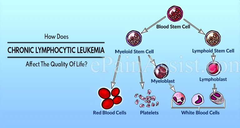 How Does Chronic Lymphocytic Leukemia Affect The Quality Of Life?