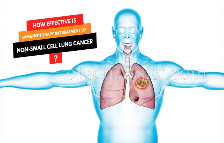 How Effective Is Immunotherapy in the Treatment of Non-Small Cell Lung Cancer & What are its Side Effects?