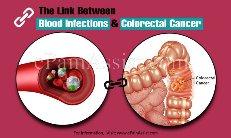 The Link Between Blood Infections and Colorectal Cancer