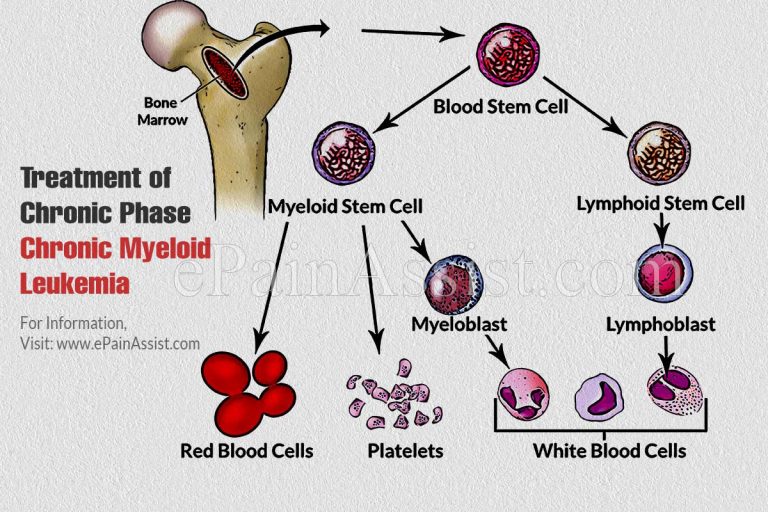 Treatment for Chronic, Accelerated, and Blast Phase Chronic Myeloid Leukemia