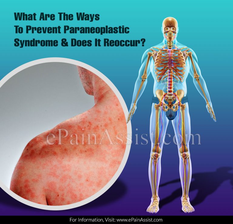 What Are The Ways To Prevent Paraneoplastic Syndrome & Does It Reoccur?