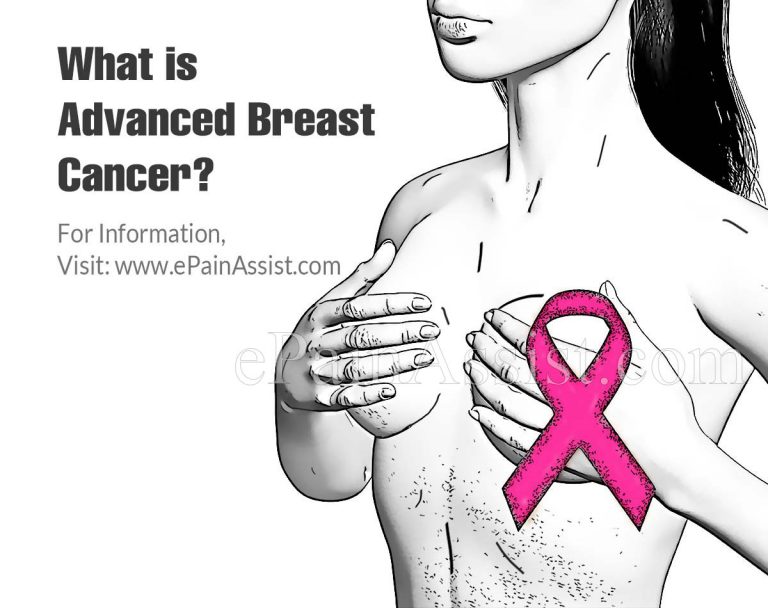 Complications of Advanced Breast Cancer