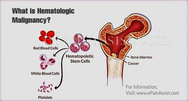 Hematologic Malignancies: Classification, Prevalence, Symptoms, Treatment, Complications