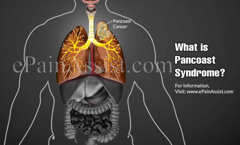 Pancoast Syndrome – Causes, Symptoms, Treatment, Prognosis