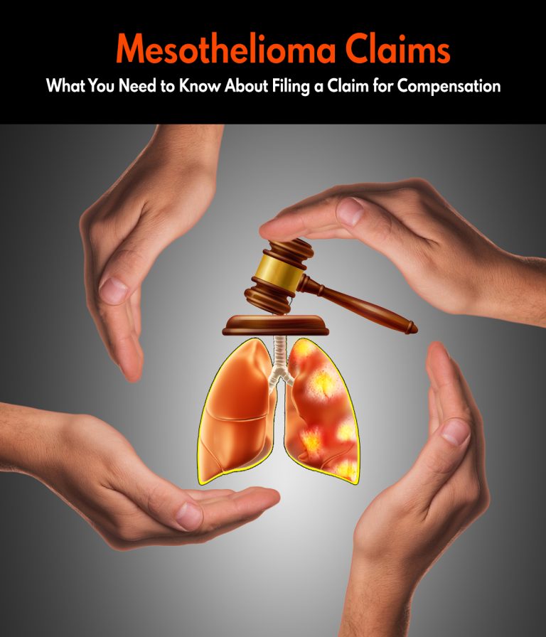 Mesothelioma Claims | What You Need to Know About Filing a Claim for Compensation