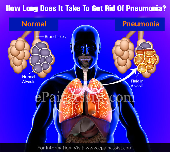 How Long Does It Take To Get Rid Of Pneumonia?