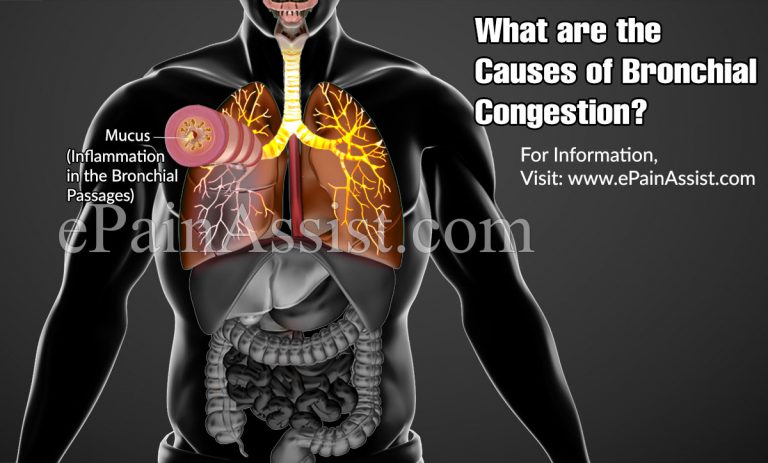 Bronchial Congestion: Causes, Symptoms, Treatment, How Long Does it Last?