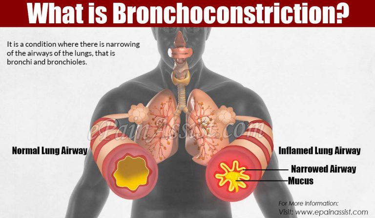 Bronchoconstriction: Causes, Symptoms, Treatment, Prognosis