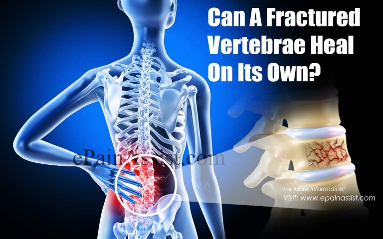 Can A Fractured Vertebrae Heal On Its Own?