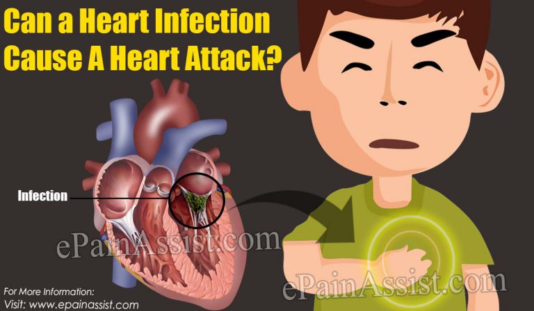 Can a Heart Infection Cause A Heart Attack?