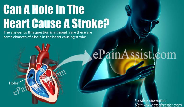 Can A Hole In The Heart Cause A Stroke?