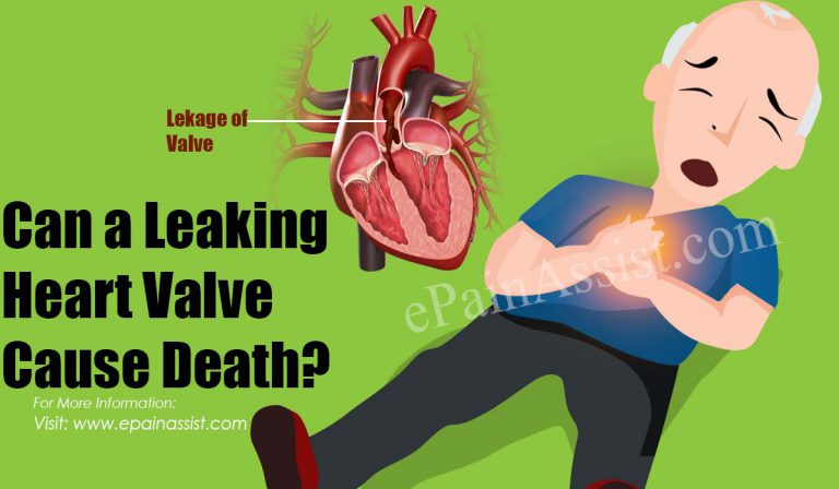 Can a Leaking Heart Valve Cause Death?
