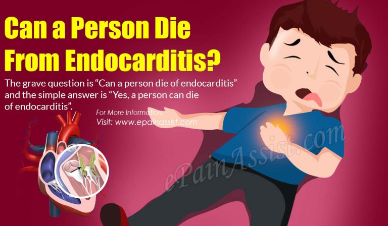 Can a Person Die From Endocarditis?