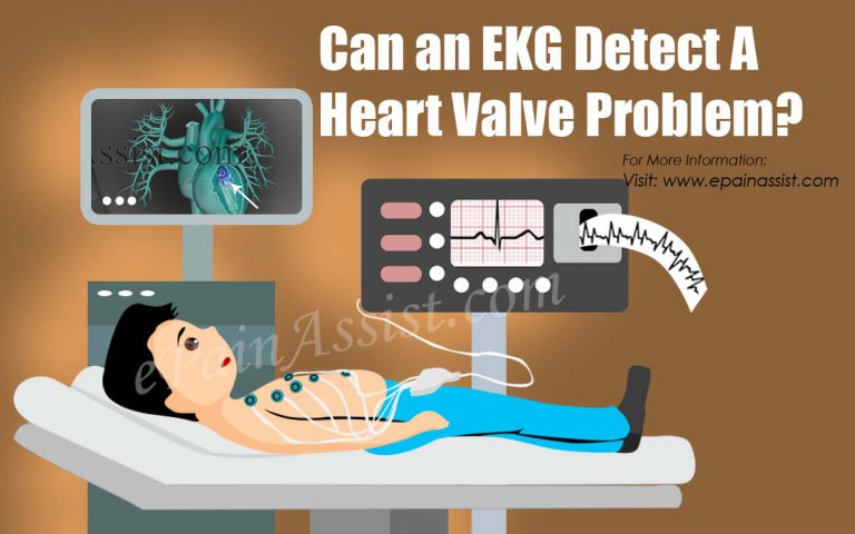 Can an EKG Detect A Heart Valve Problem?
