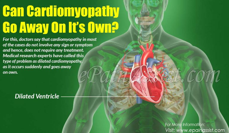 Can Cardiomyopathy Go Away On It’s Own?