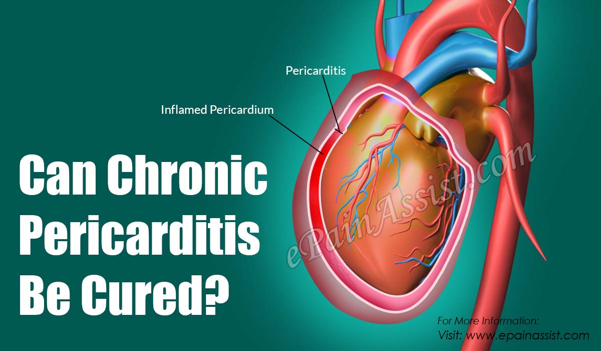 Can Chronic Pericarditis Be Cured?