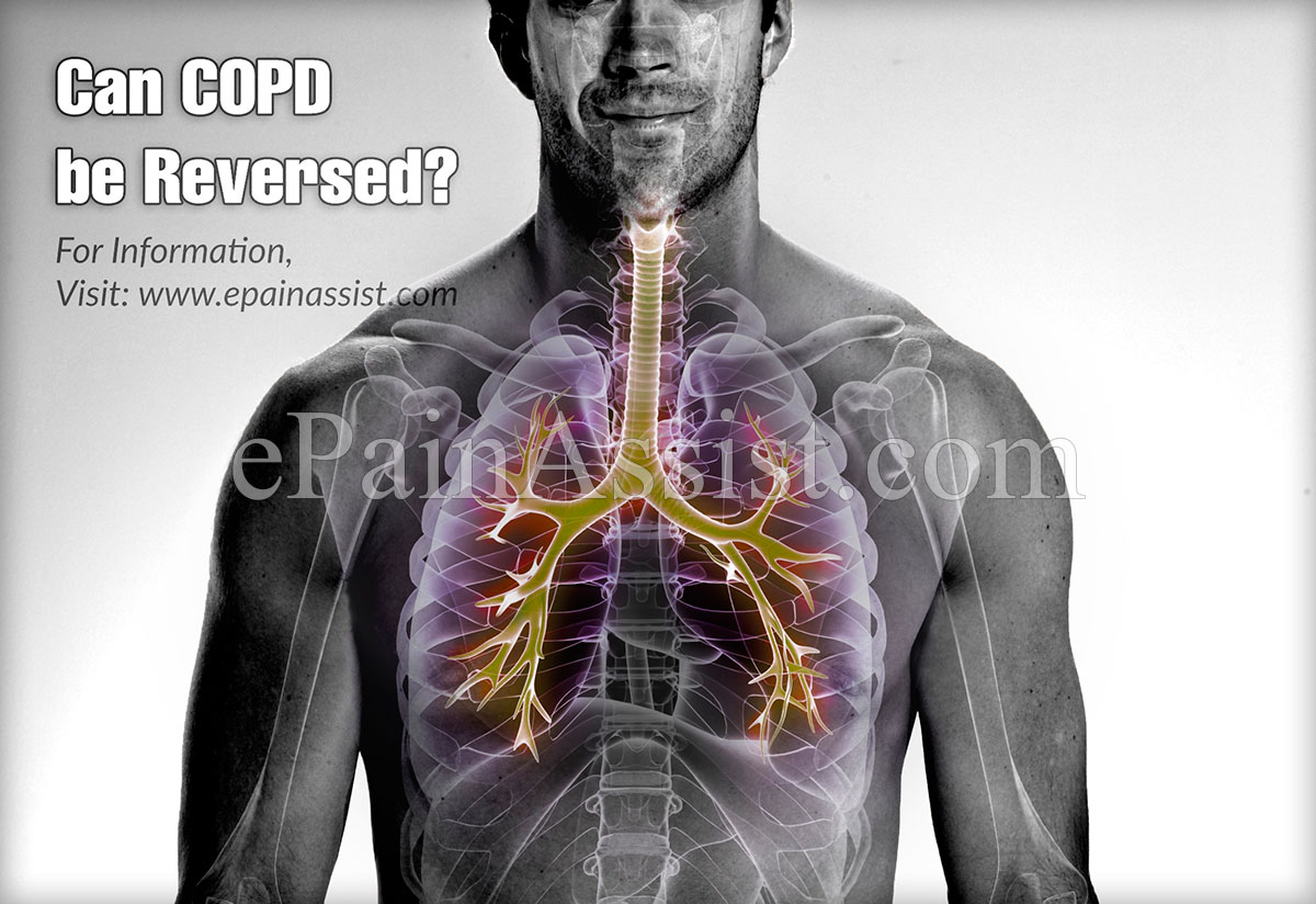 Can COPD be Reversed?