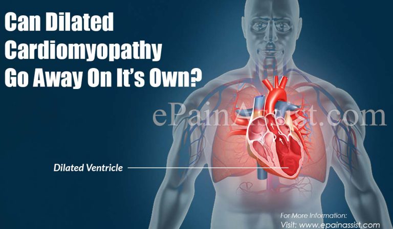 Can Dilated Cardiomyopathy Go Away On It’s Own?