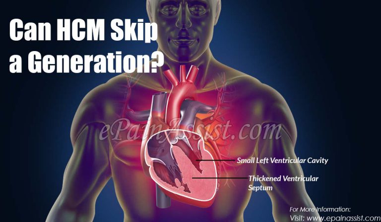 Can HCM Skip a Generation?