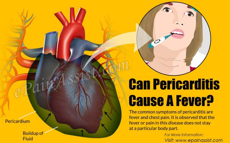 Can Pericarditis Cause A Fever?