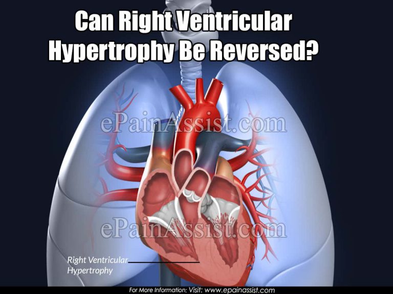 Can Right Ventricular Hypertrophy Be Reversed?