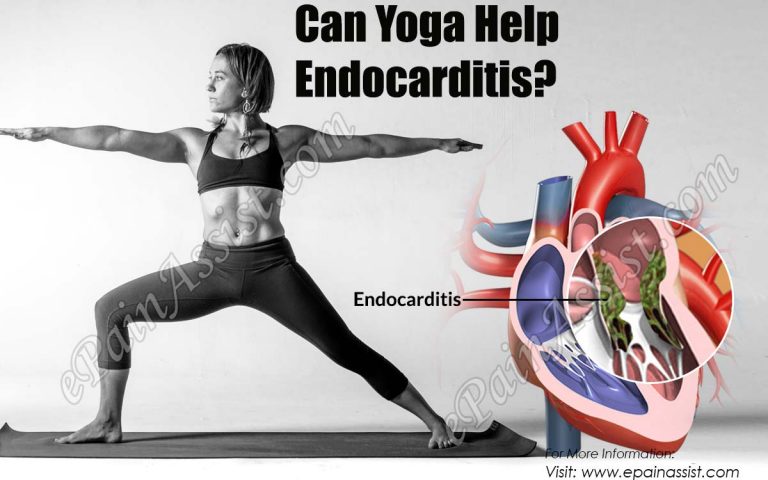 Can Yoga Help Endocarditis?