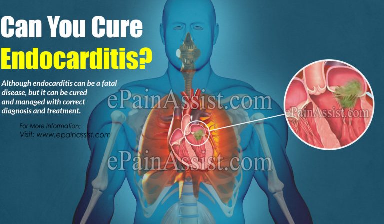 Can You Cure Endocarditis?
