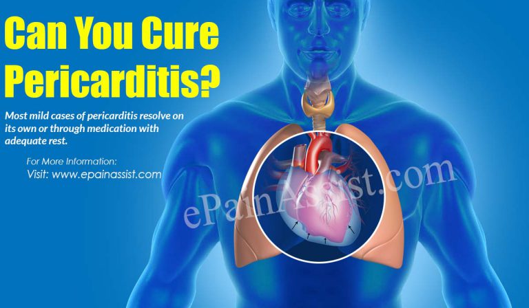 Can You Cure Pericarditis?