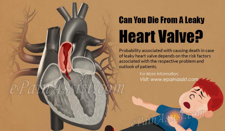 Can You Die From A Leaky Heart Valve?