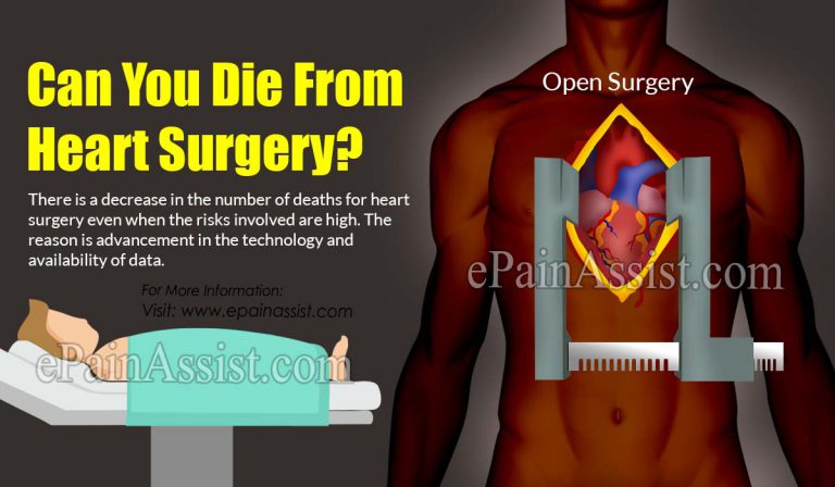 Can You Die From Heart Surgery?