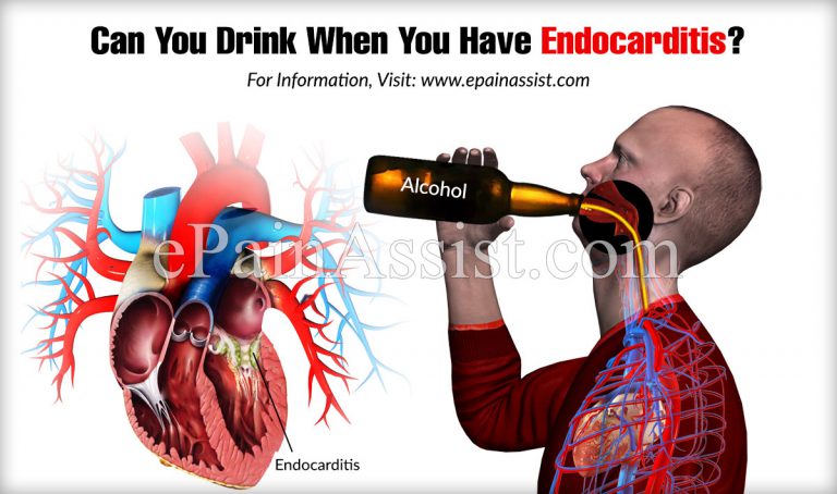 Can You Drink When You Have Endocarditis?