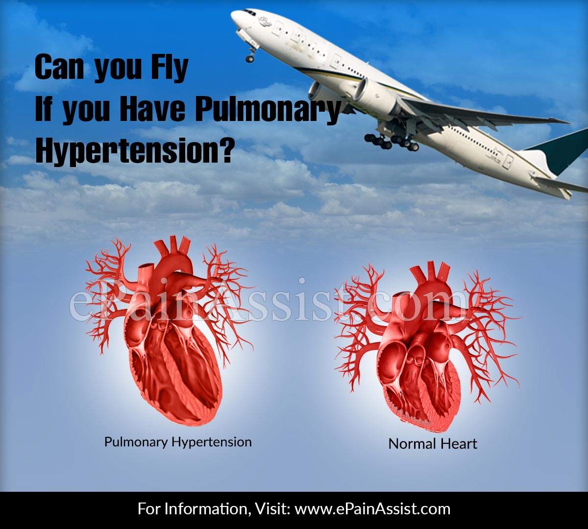 Can You Fly If You Have Pulmonary Hypertension?